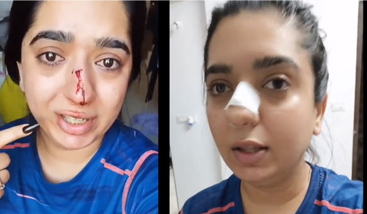 Watch: Food delivery boy punches woman in face, leaves her with broken nose